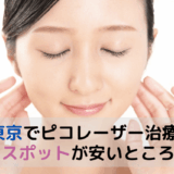 東京でピコスポットが安いところを調査